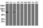 PPARA Antibody in Western Blot (WB)