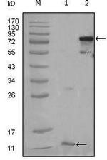 PPAR gamma Monoclonal Antibody (3A4A9, 1E6A1)