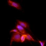 PPAR gamma-2 Antibody in Immunocytochemistry (ICC/IF)