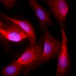 PPAR gamma-2 Polyclonal Antibody, Alexa Fluor™ 647