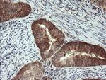 PPAT Antibody in Immunohistochemistry (Paraffin) (IHC (P))