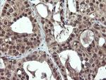 PPAT Antibody in Immunohistochemistry (Paraffin) (IHC (P))