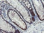 PPAT Antibody in Immunohistochemistry (Paraffin) (IHC (P))
