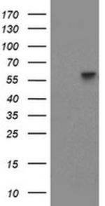 PPAT Antibody in Western Blot (WB)