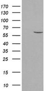 PPAT Antibody in Western Blot (WB)
