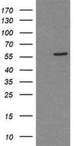 PPAT Antibody in Western Blot (WB)