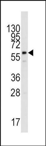 PPAT Antibody in Western Blot (WB)