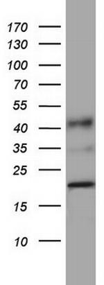 PPIH Antibody in Western Blot (WB)