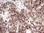 PPIL1 Antibody in Immunohistochemistry (Paraffin) (IHC (P))