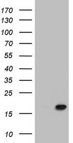 PPIL1 Antibody in Western Blot (WB)