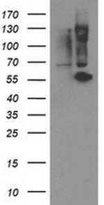 PPM1B Antibody in Western Blot (WB)