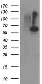 PPM1B Antibody in Western Blot (WB)