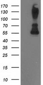 PPM1B Antibody in Western Blot (WB)