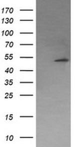PPM1B Antibody in Western Blot (WB)