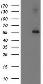 PPM1B Antibody in Western Blot (WB)