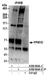 PPM1D Antibody in Western Blot (WB)