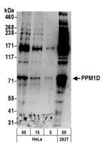 PPM1D Antibody in Western Blot (WB)