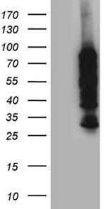 PPM1D Antibody in Western Blot (WB)