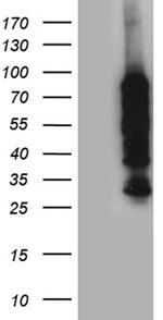 PPM1D Antibody in Western Blot (WB)