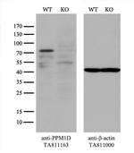 PPM1D Antibody in Western Blot (WB)