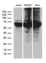 PPM1D Antibody in Western Blot (WB)