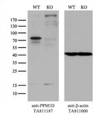 PPM1D Antibody in Western Blot (WB)