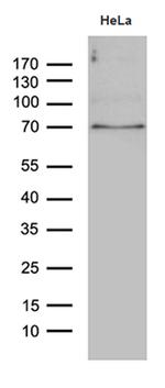 PPM1D Antibody in Western Blot (WB)