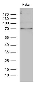 PPM1D Antibody in Western Blot (WB)