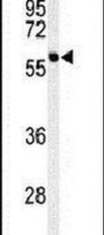 PPM1G Antibody in Western Blot (WB)