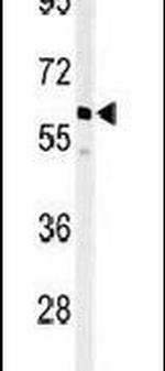 PPM1G Antibody in Western Blot (WB)