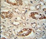 PPM1L Antibody in Immunohistochemistry (IHC)