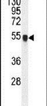 PPM1L Antibody in Western Blot (WB)
