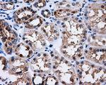 PPME1 Antibody in Immunohistochemistry (Paraffin) (IHC (P))