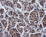 PPME1 Antibody in Immunohistochemistry (Paraffin) (IHC (P))