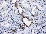 PPME1 Antibody in Immunohistochemistry (Paraffin) (IHC (P))