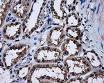 PPME1 Antibody in Immunohistochemistry (Paraffin) (IHC (P))