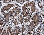 PPME1 Antibody in Immunohistochemistry (Paraffin) (IHC (P))