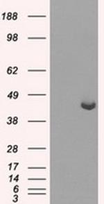 PPME1 Antibody in Western Blot (WB)
