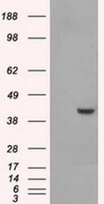 PPME1 Antibody in Western Blot (WB)