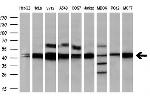 PPME1 Antibody in Western Blot (WB)