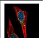 PP1 alpha Antibody in Immunocytochemistry (ICC/IF)