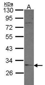 PP1 alpha Antibody in Western Blot (WB)