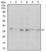 PP1 alpha Monoclonal Antibody (5E9)