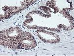 PPP1R15A Antibody in Immunohistochemistry (Paraffin) (IHC (P))