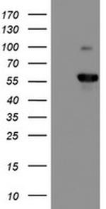 PPP1R15A Antibody in Western Blot (WB)