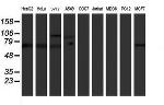 PPP1R15A Antibody in Western Blot (WB)