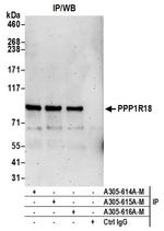 PPP1R18 Antibody in Western Blot (WB)