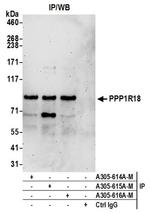 PPP1R18 Antibody in Western Blot (WB)