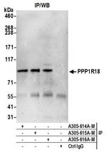 PPP1R18 Polyclonal Antibody