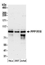 PPP1R18 Polyclonal Antibody